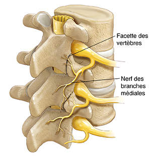 Vue de trois quarts de trois vertèbres et de disques montrant la moelle épinière, les nerfs spinaux et les nerfs des branches médiales.