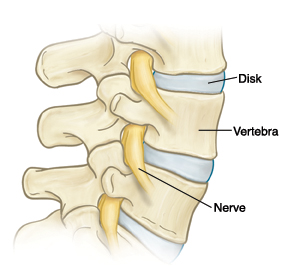 Side view of lumbar spine showing vertebrae, disks, and nerves.