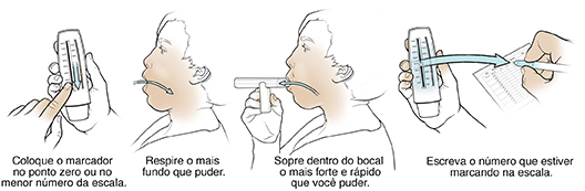Cinco passos no uso de um medidor de pico de fluxo expiratório.